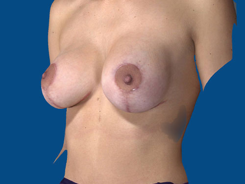 After Image