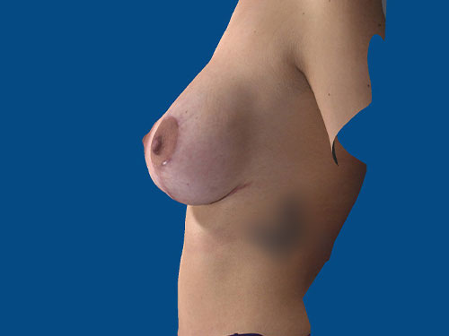After Image