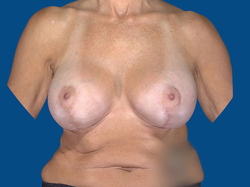 After Image