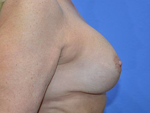 After Image