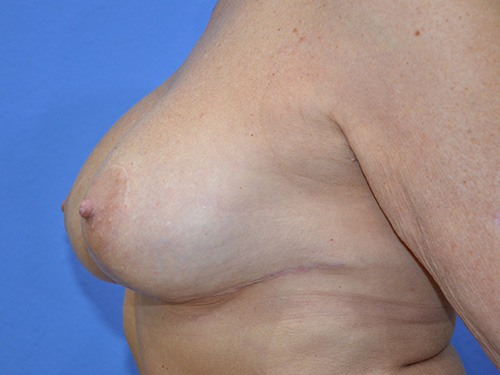 After Image