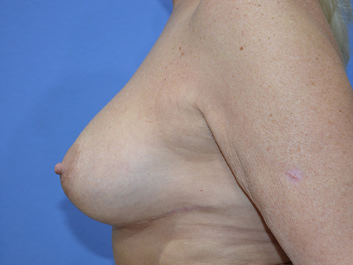 After Image