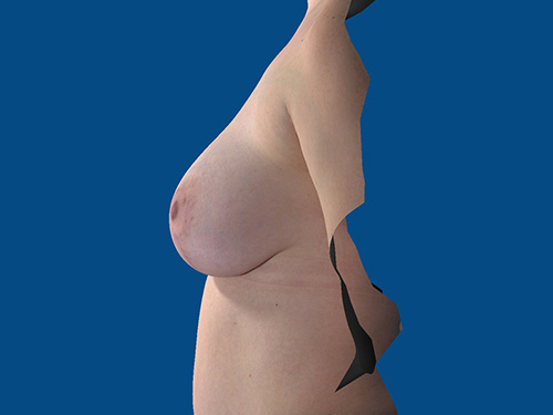 After Image