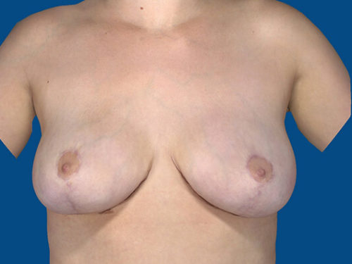 After Image