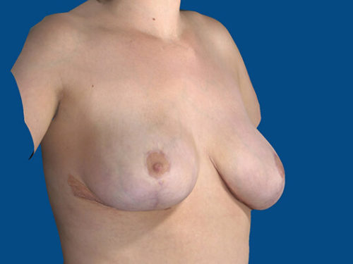 After Image