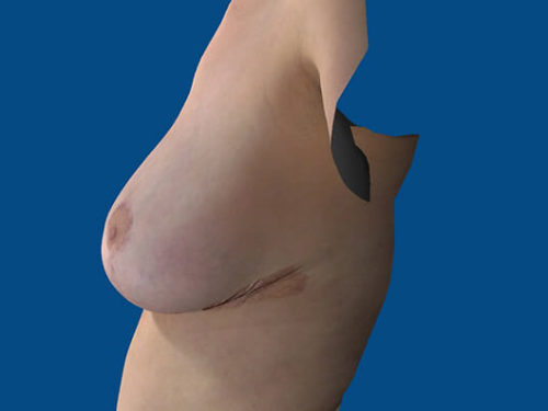 After Image