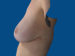 After Image