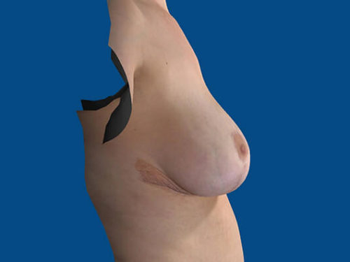 After Image