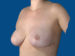 After Image