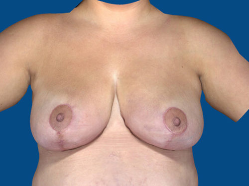 After Image