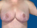 After Image