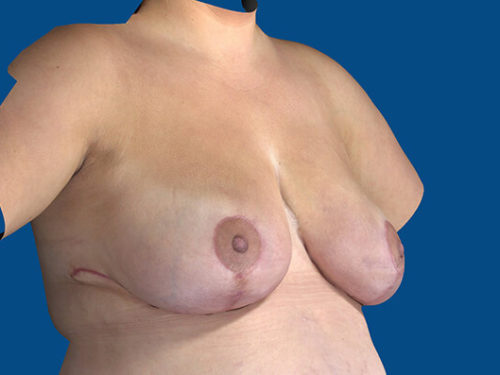 After Image