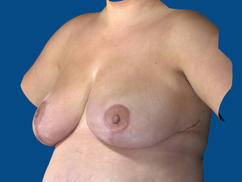 After Image