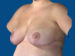 After Image