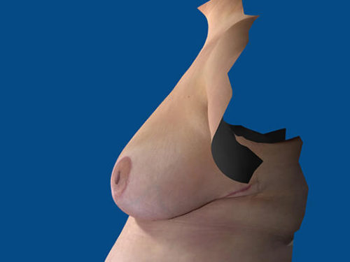 After Image