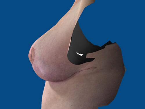 After Image