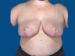 After Image