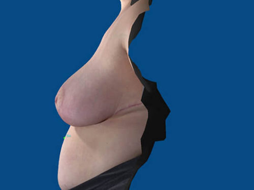 After Image