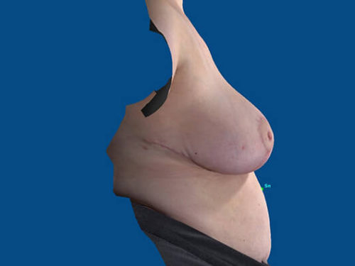 After Image