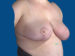 After Image