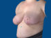After Image