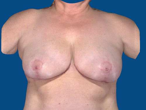 After Image