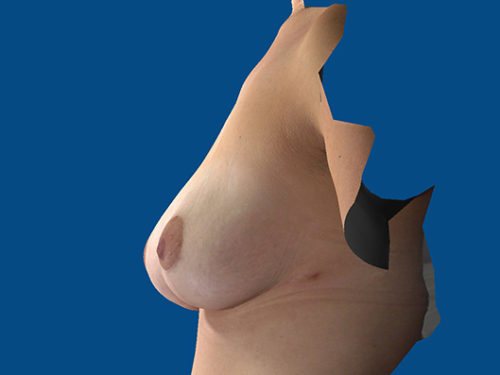 After Image