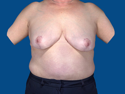 After Image