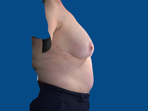 After Image