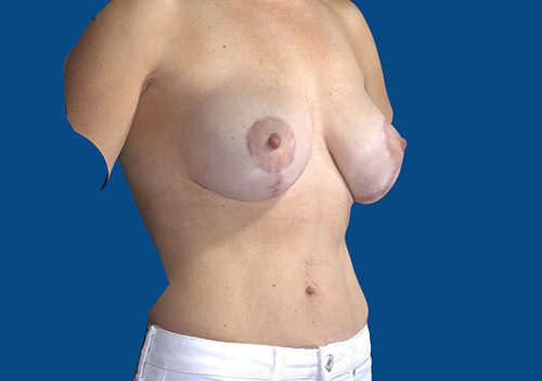 After Image