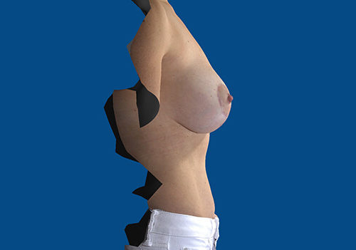 After Image