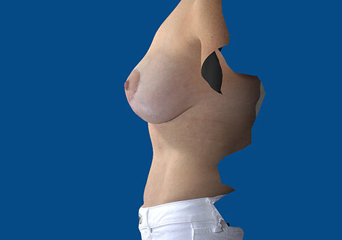 After Image