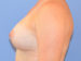 After Image