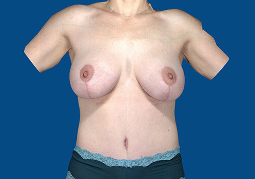 After Image