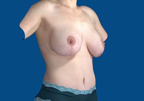 After Image