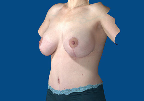 After Image