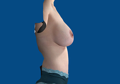 After Image