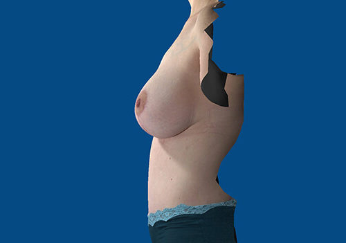 After Image