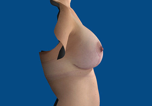 After Image