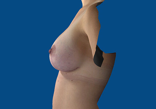 After Image
