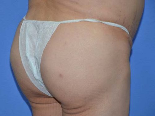 After Image