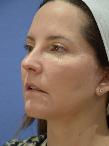 After Image