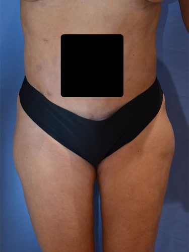 After Image
