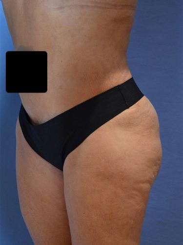 After Image
