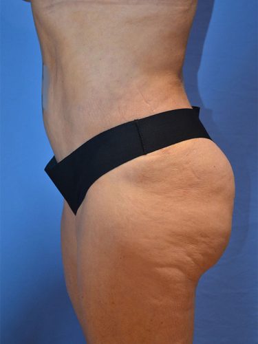 After Image