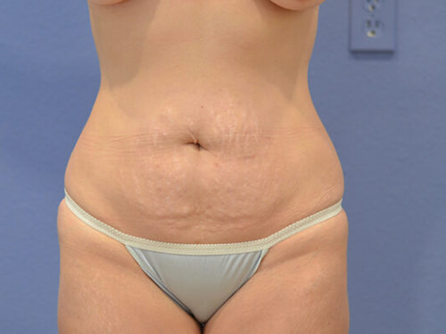 Before Image