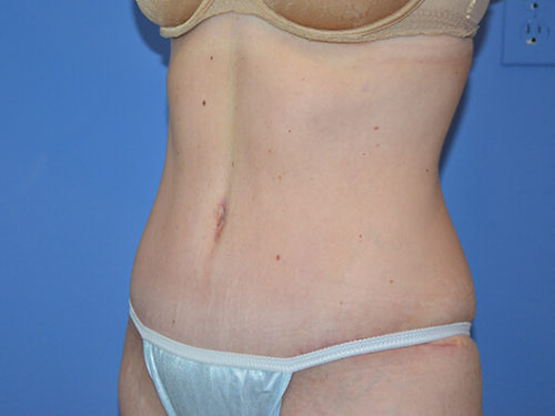 After Image