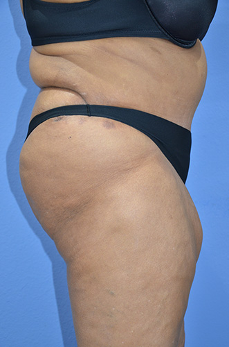 After Image