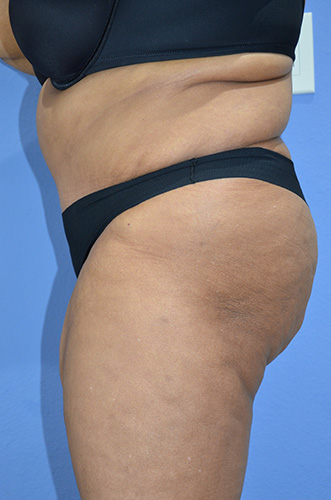 After Image