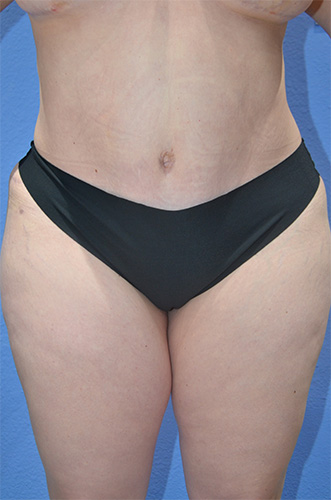 After Image